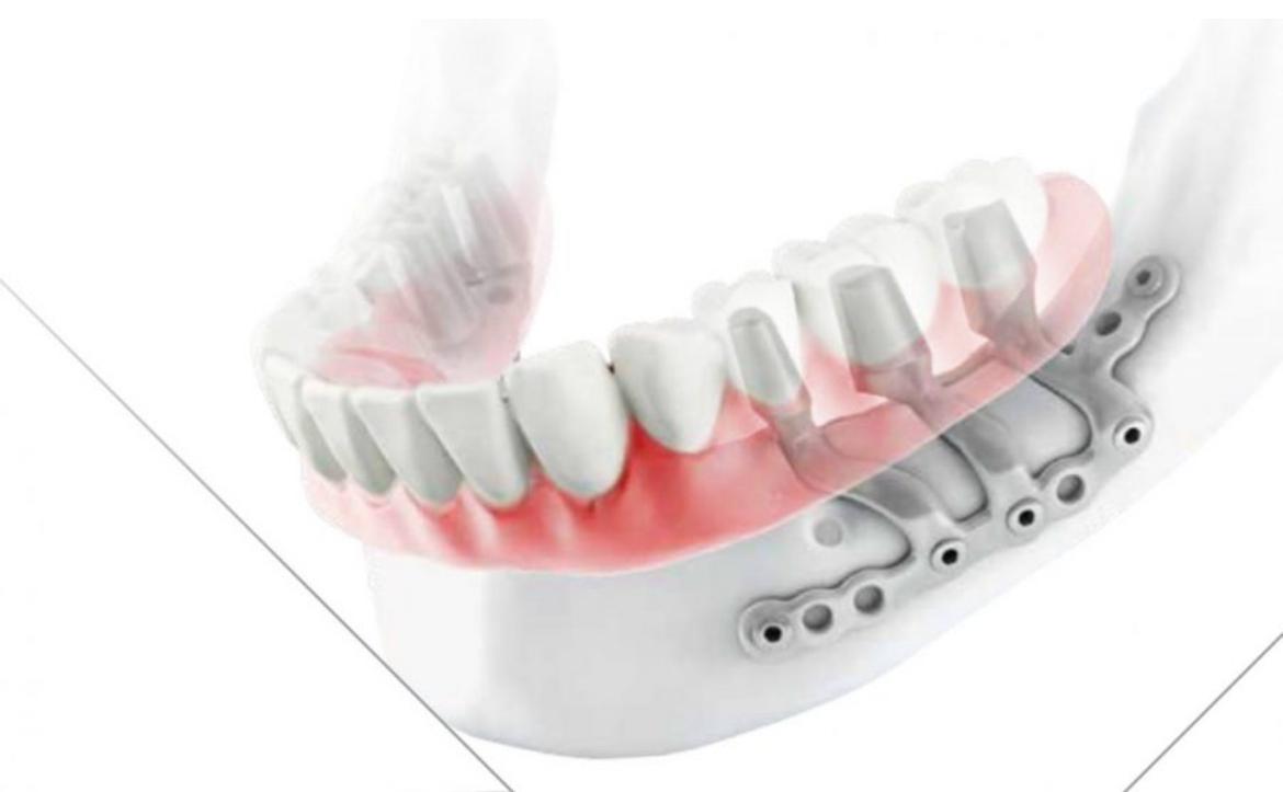 Immagine WhatsApp ore - menu - impianti-dentali-senza-osso